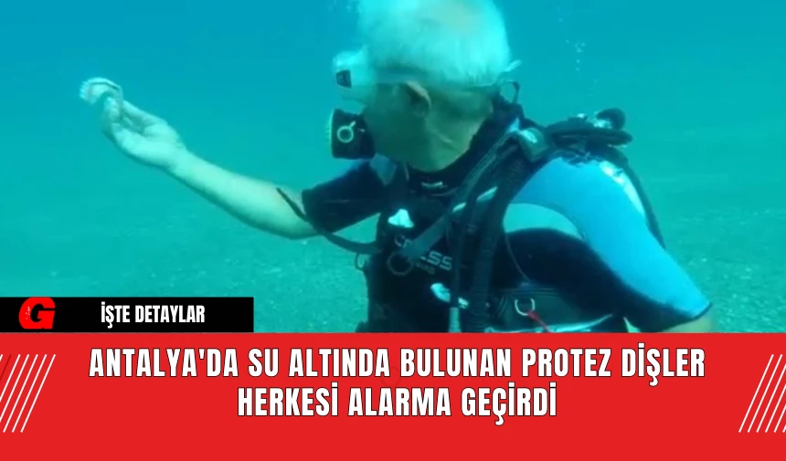 Antalya'da Su Altında Bulunan Protez Dişler Herkesi Alarma Geçirdi