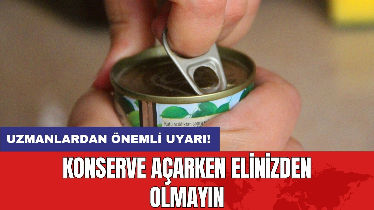 Uzmanlardan önemli uyarı! Konserve açarken elinizden olmayın