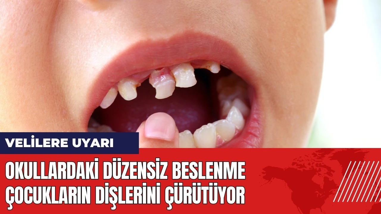 Okullardaki düzensiz beslenme çocukların dişlerini çürütüyor