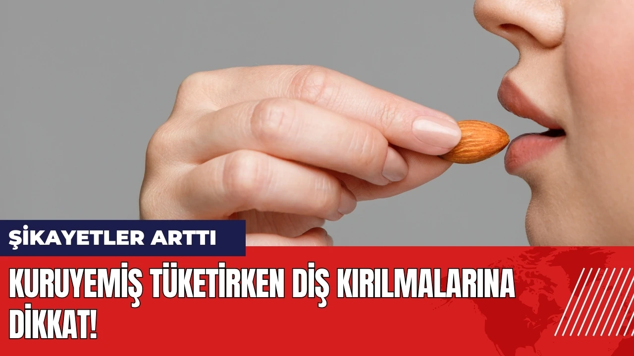 Kuruyemiş tüketirken diş kırılmalarına dikkat! Şikayetler arttı