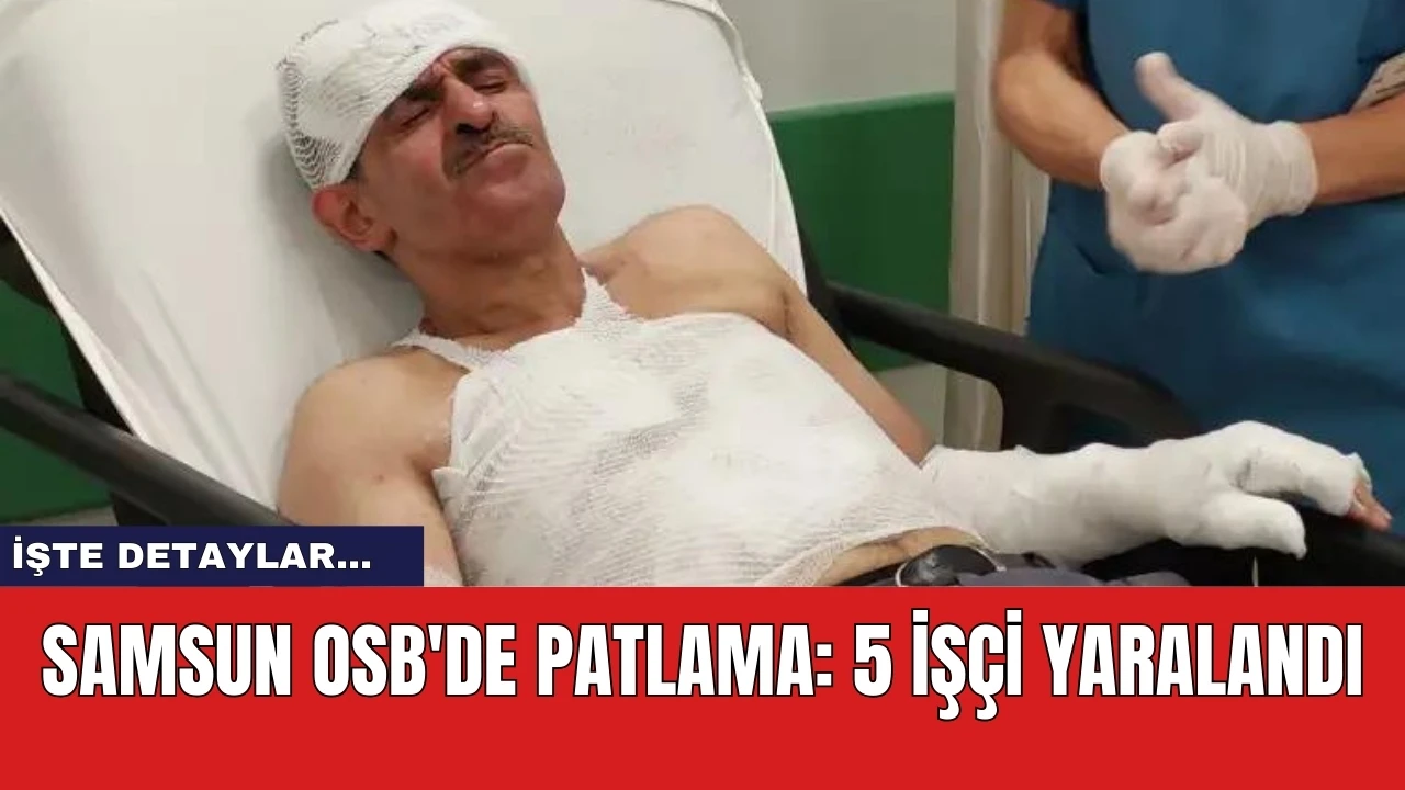 Samsun OSB'de patlama: 5 işçi yaralandı